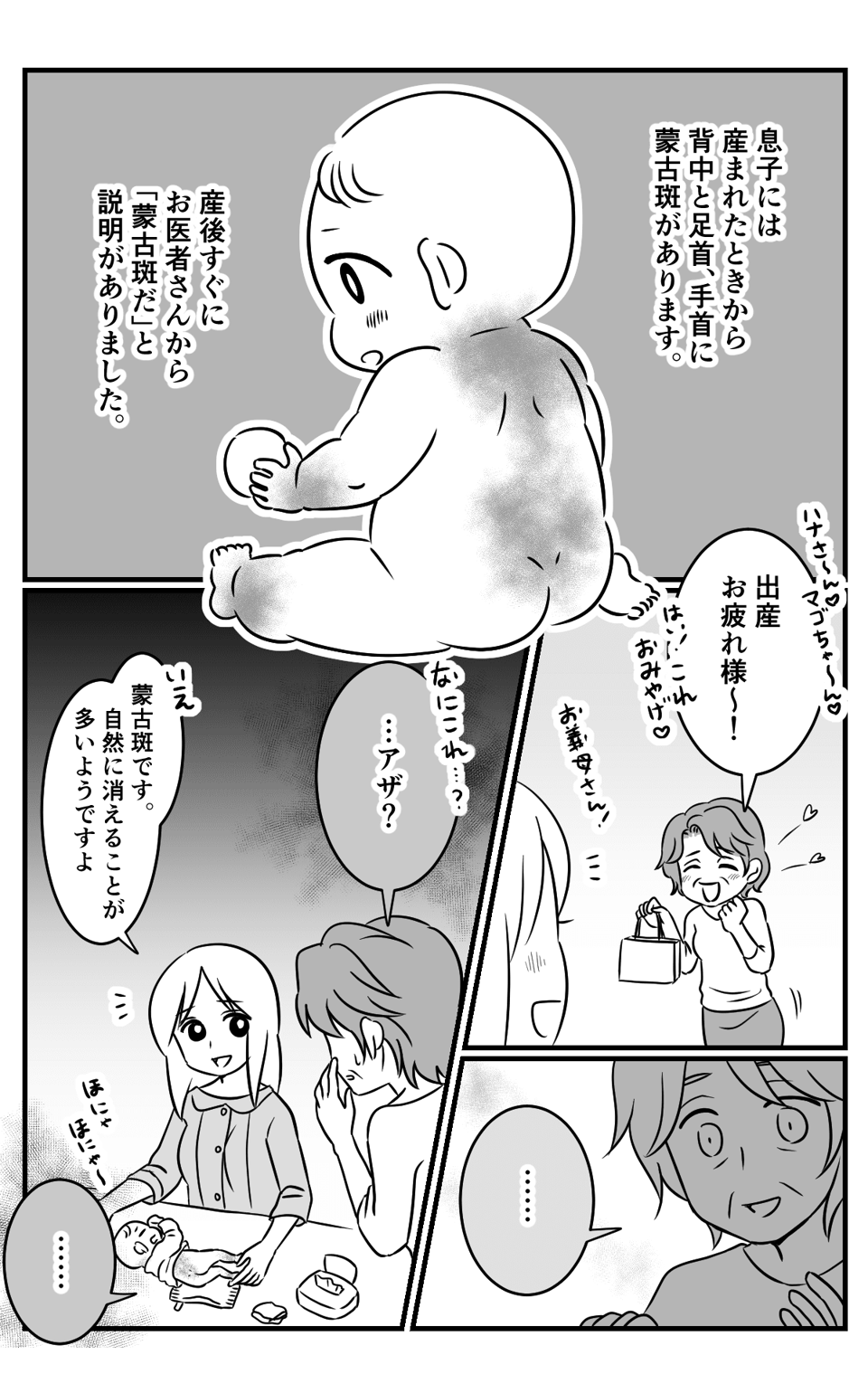 赤ちゃんの蒙古斑を「虐待だ」と義母が通報!行動がエスカレートして最終的に_1_1