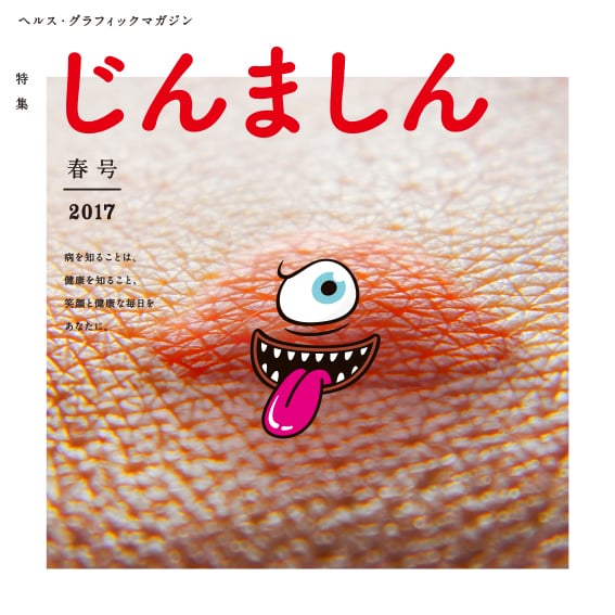 2017年4月発行の最新号は「じんましん」特集！　お子さんの蕁麻疹にお悩みのご家庭はぜひご一読を。