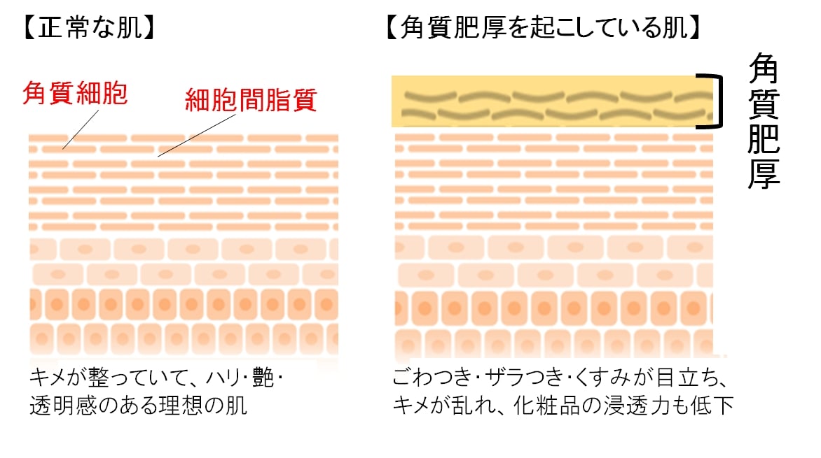 導入液 がカギ 医師が教える スキンケア効果が実感できない原因 とは ママスタセレクト