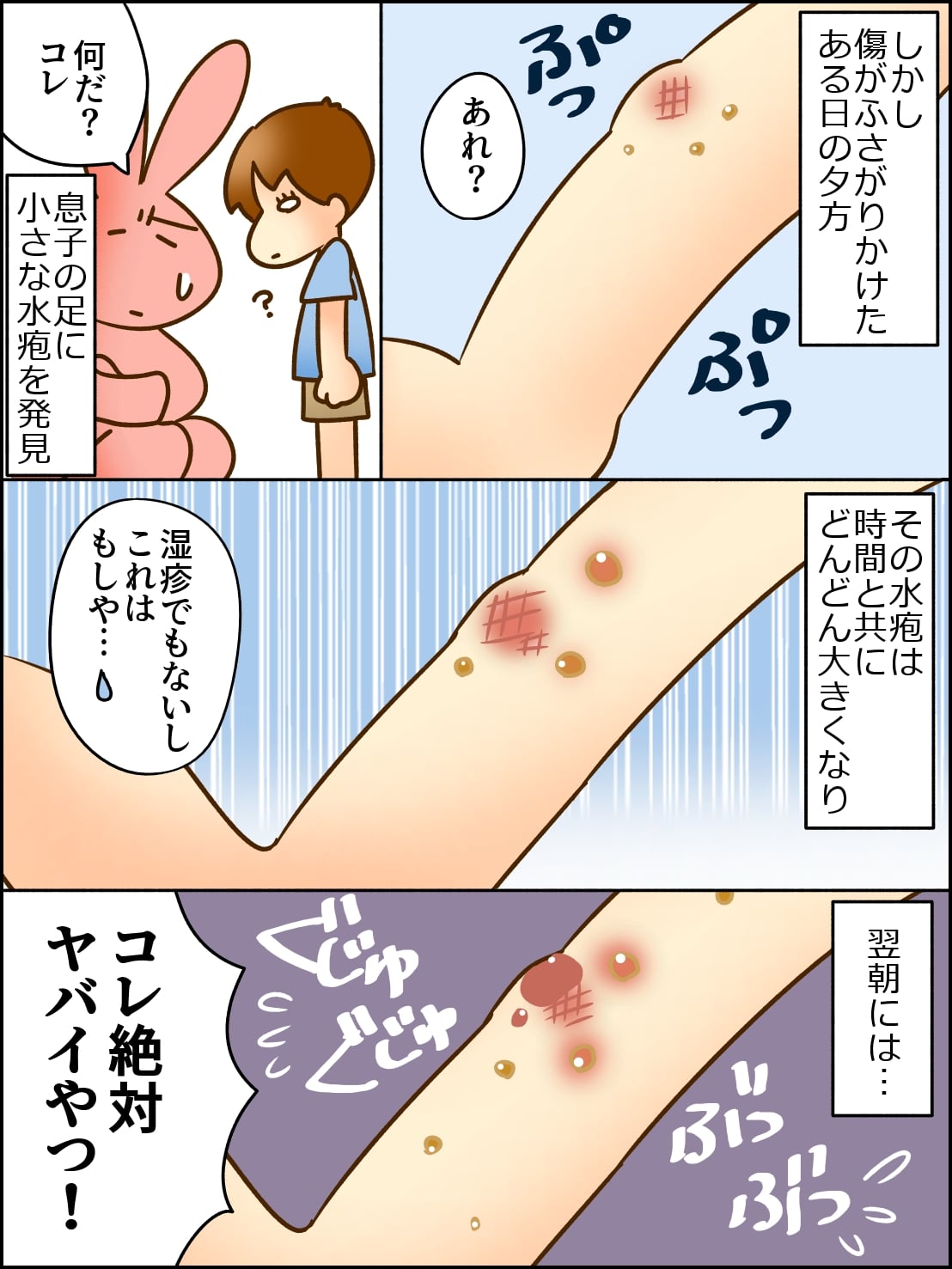 本当に 飛び火 なんだ 2歳息子 初めての とびひ治療記 ママスタセレクト
