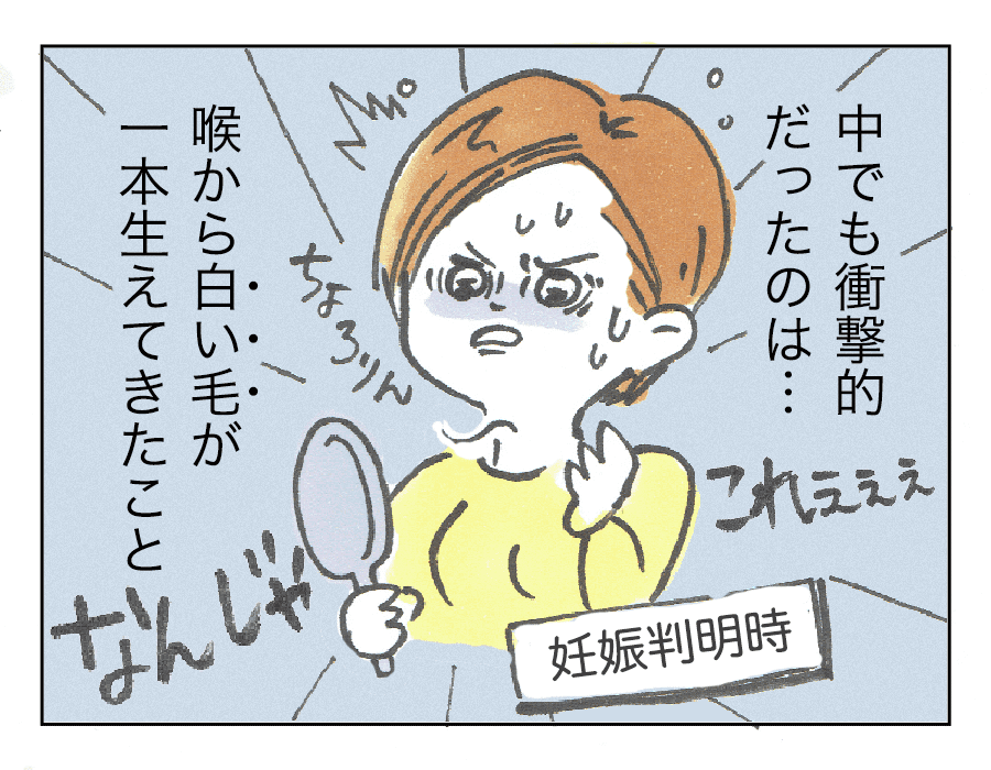 わたしの毛事情03